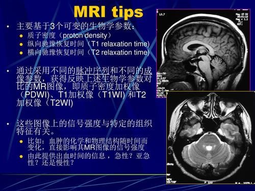 MRI